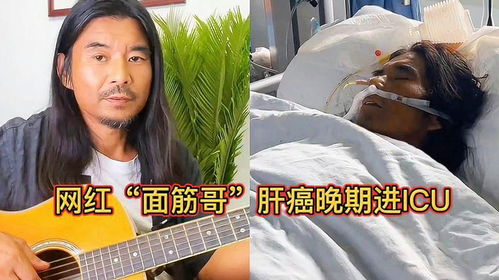 网红面筋哥肝癌晚期进icu,面黄肌瘦表情痛苦,医院已下病危