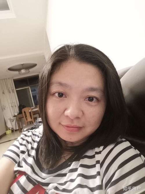 30岁的女性皮肤状态都是什么样的不要滤镜