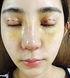 女大学生为成网红花100万整成迪丽热巴,网友甩胖迪无数条街
