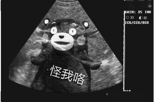 荟乐刚怀孕,妈妈却说