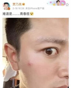 贾乃亮晒照脸上长痘表情搞怪,网友给李小璐看吗