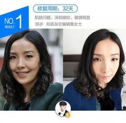 女人平常这样做,脸上皱纹全没,40岁活成20岁