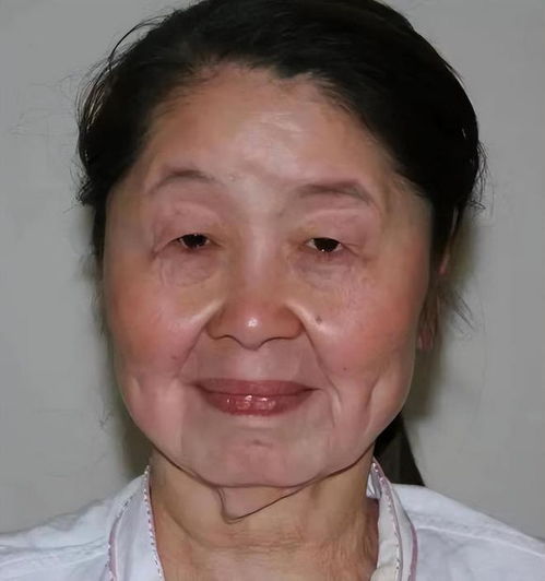 河南20岁女子生完孩子,竟一夜变成60岁老人,老公我还爱她