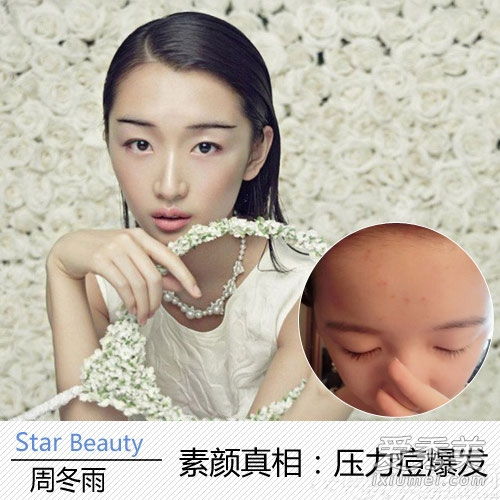 90后女演员长得又丑又丑,以至于郑爽和周东宇脸上都长满了粉刺