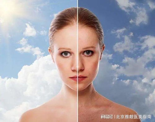 北京雅靓医疗美容一白遮百丑,如何祛除面部色斑