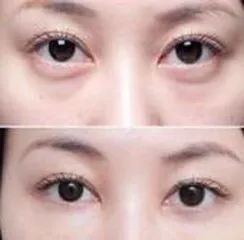 60岁女人用什么微信头像最好洗脸
