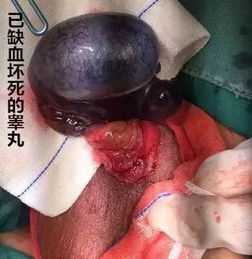 四十岁男人头像真实照片睾丸检查