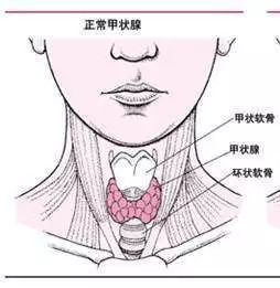 35岁女强人怀二胎查出癌症女性高发癌这里的结节你有吗