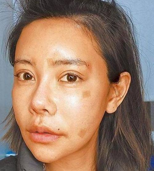 39岁女子整容21年,花37万元整容60次,从丑女瞬间变美女