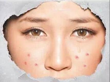 郑州肤康皮肤科冬天身上不断冒痘的源头竟是它们