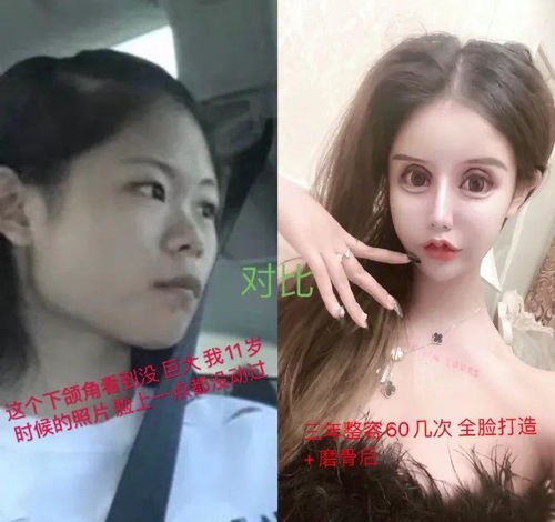 16岁少女整容60次成功做网红,脸部投资过百万,换来更多嘲笑声