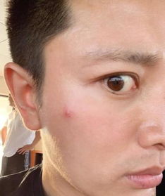 贾乃亮晒照脸上长痘表情搞怪,网友给李小璐看吗