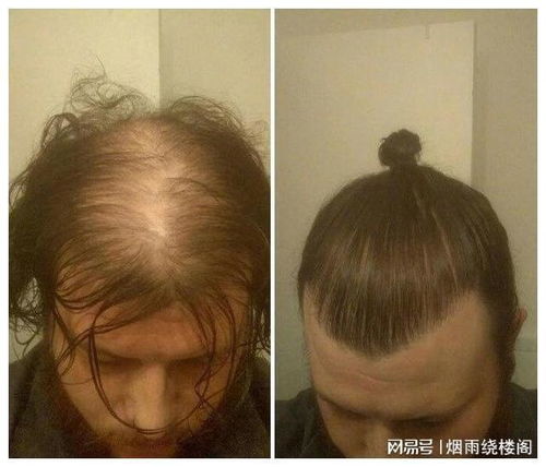 看到一些扎辫子的男孩子,其实并不是因为他们的头发很多哈哈哈哈