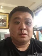 动物园猴子长了张人脸,自带表情包网友工作人员顶替的