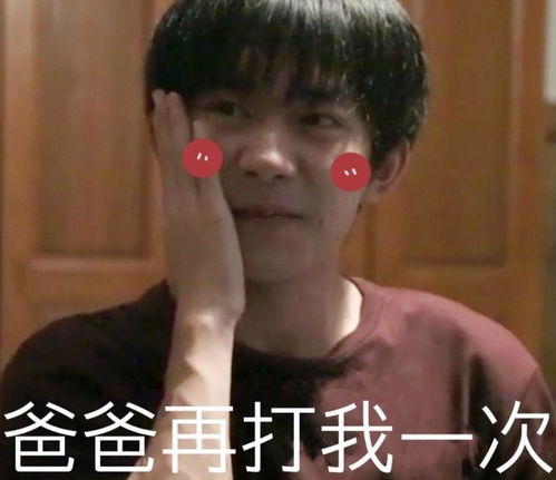 玺子哥这脸都打肿了