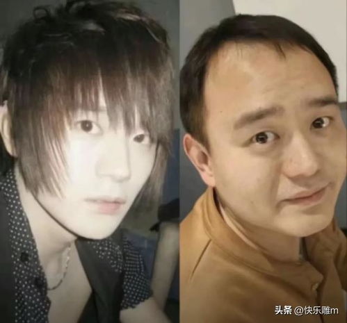 心酸04年男生晒自己容貌对比照网友哭喊原来这就是青春的样子