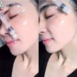 40岁女人有皱纹贼显老,每晚抹点去皱好货,满脸的胶原蛋白