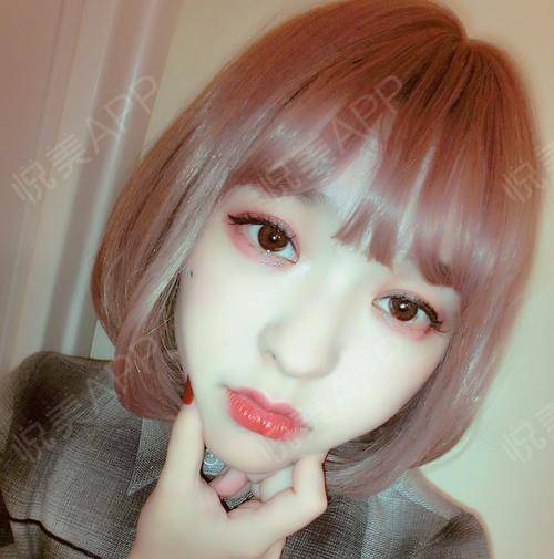 漫画少女少女上线,有一起玩cosplay的吗从小就很喜...面部填充悦美整形