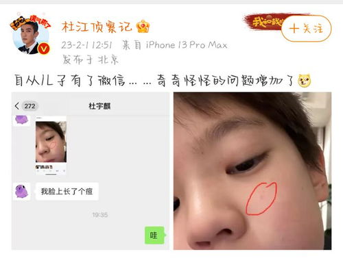 杜江晒与儿子聊天记录,9岁嗯哼长青春痘好苦恼,用的头像好可爱