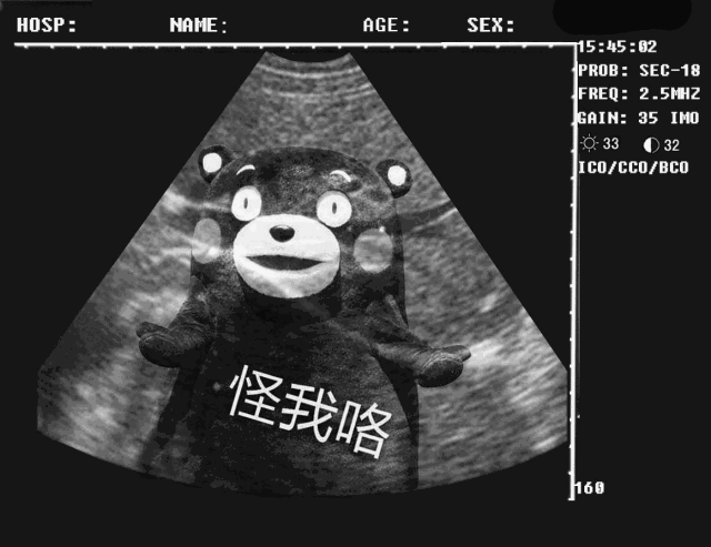 表情抖音b超怀孕搞笑图片大全抖音b超恶搞表情包无水印分享66游戏网表情